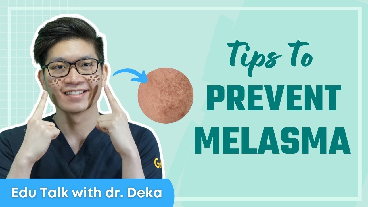 Secret Tips to Prevent Melasma / Muncul Flek Hitam?!! Tips Pencegahan Melasma!