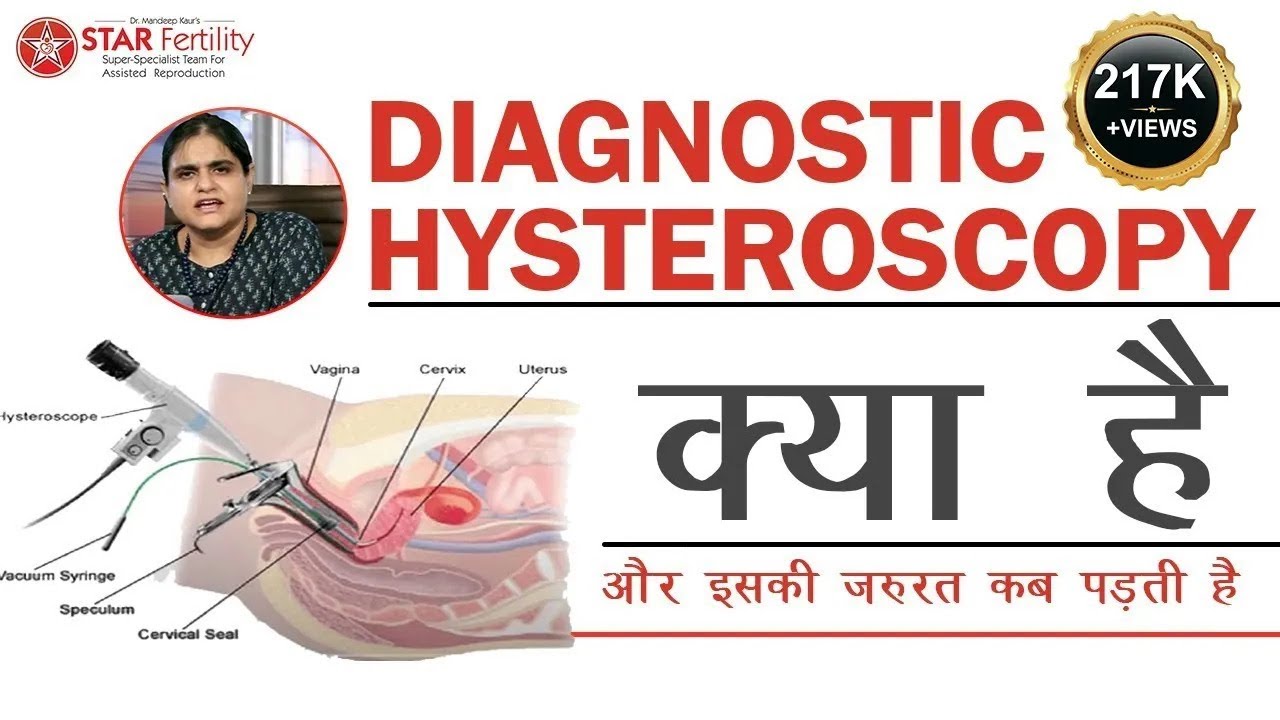 Diagnostic Hysteroscopy in Hindi, Before IVF, Diagnostic Test, Laparoscopy, Infertility Treatment