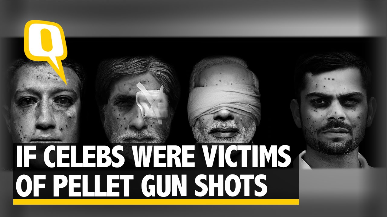 The Quint: What if Celebrities were Victims of Pellet Guns?