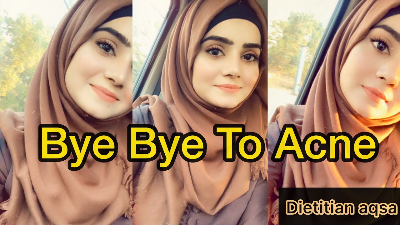 Best Acne Treatment | Home Remedy For Pimples | Dietitianaqsa