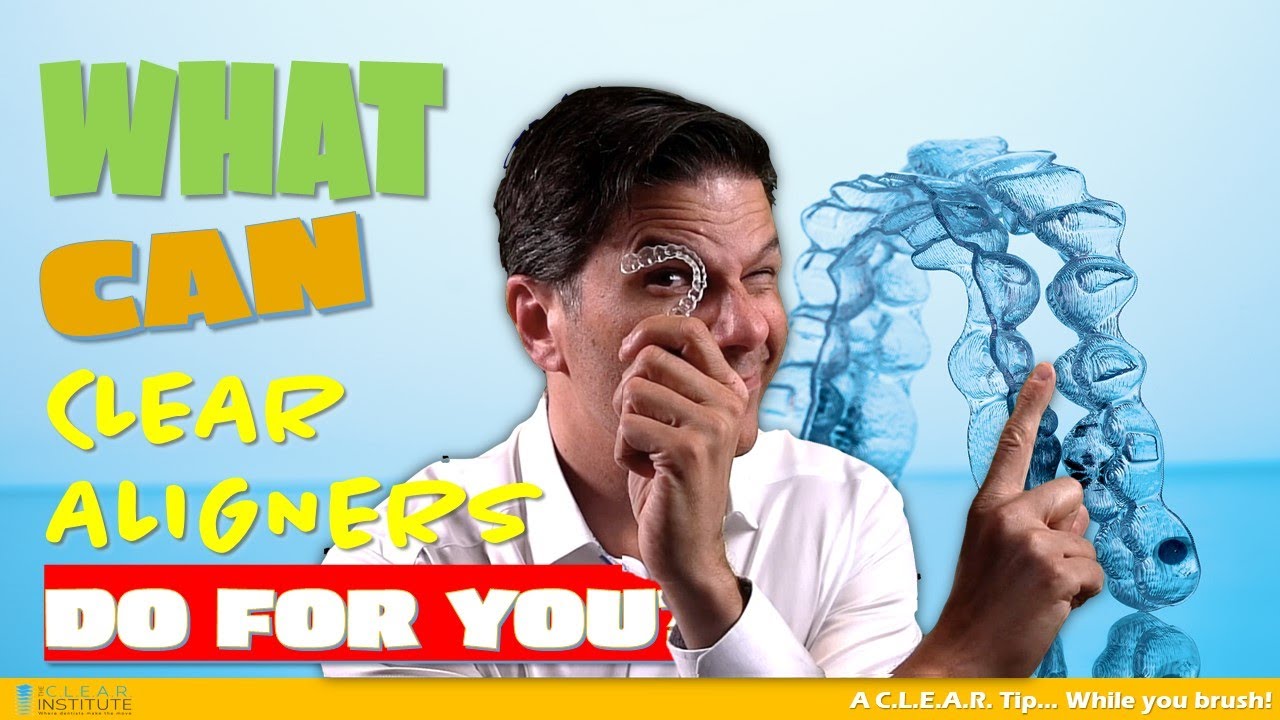 What can clear aligners do for you and what are the limits of Invisalign?