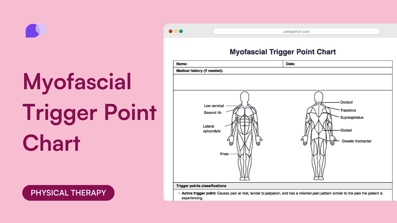 All about myofascial trigger point chart