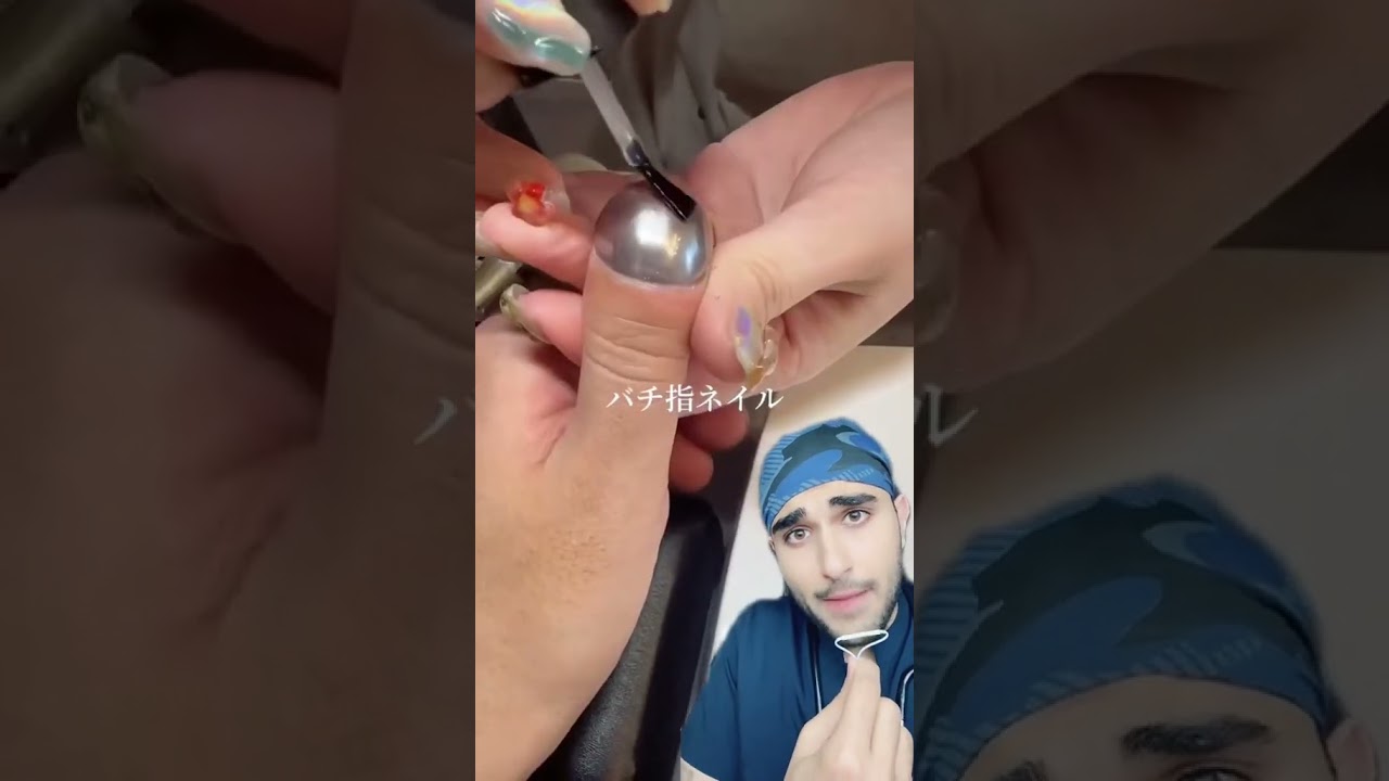 Dedos en palillo de tambor