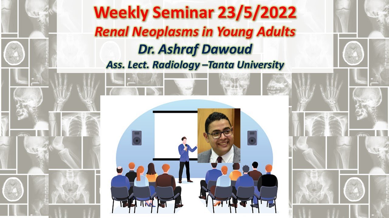 Renal Neoplasms in Young Adults (Recorded Live)