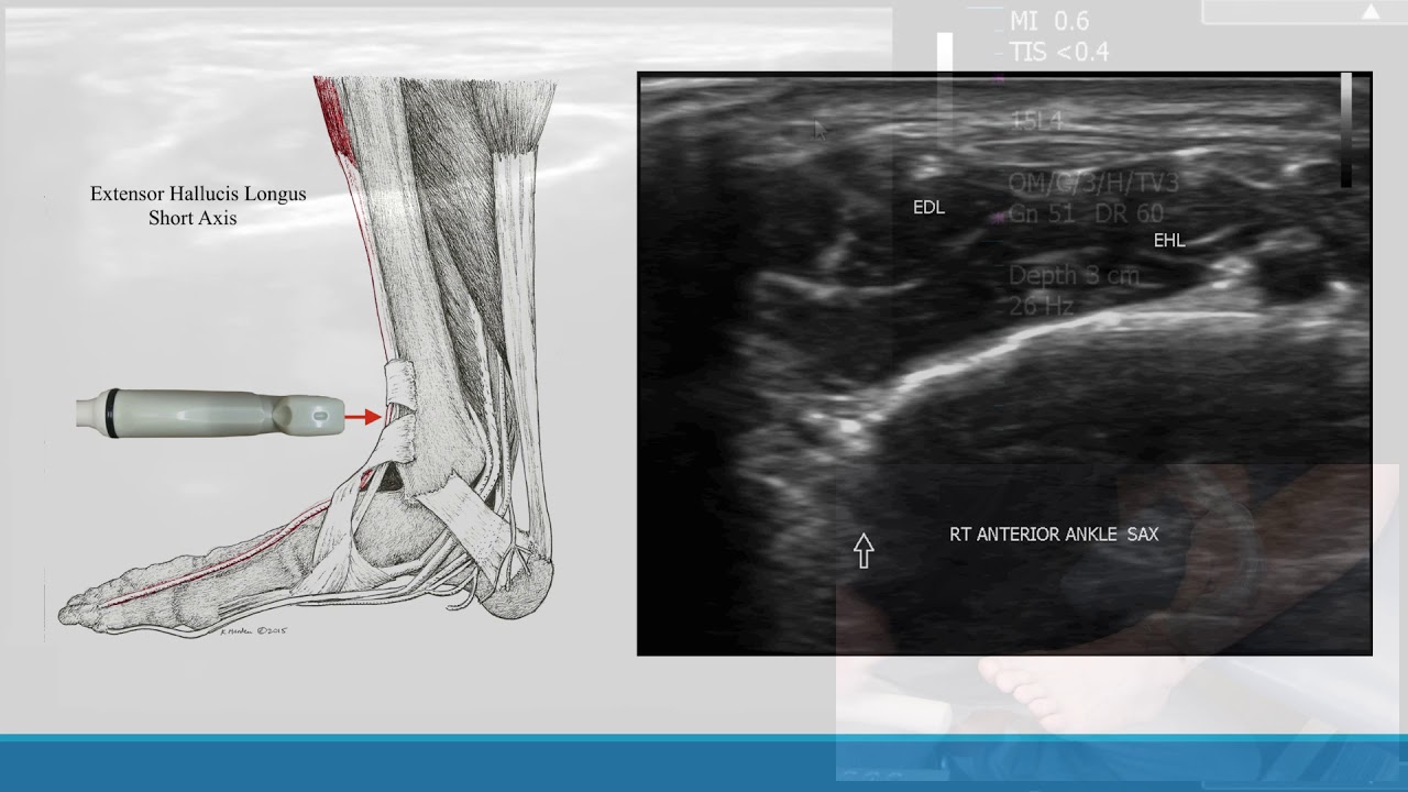Ankle   Anterior Exam
