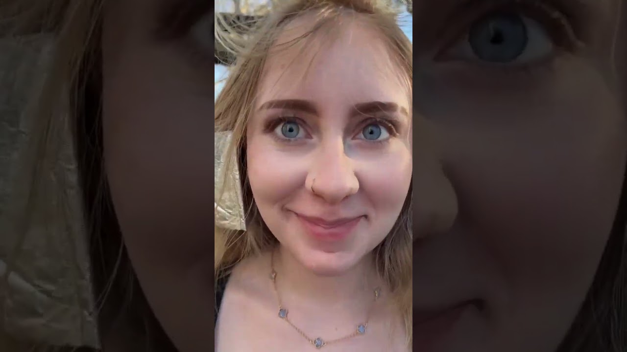 Best Hair Transformation 