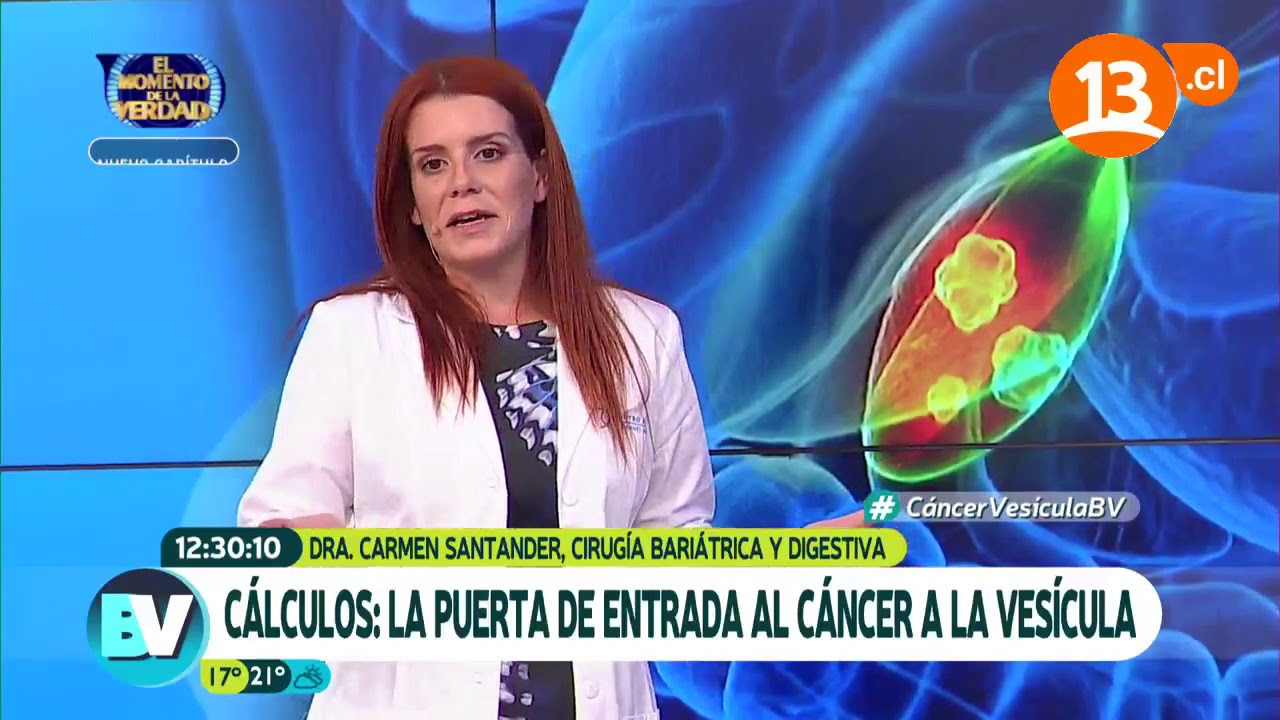 Conoce el cáncer de vesícula (Parte 1) | Bienvenidos