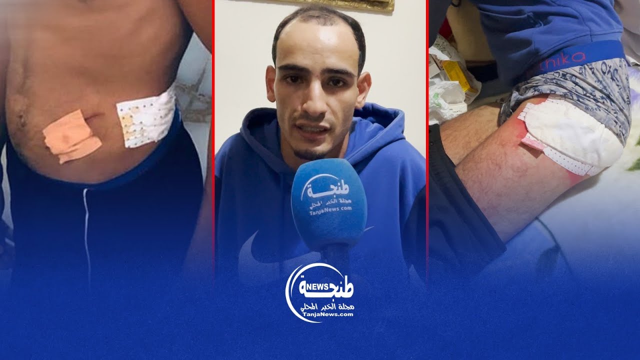شاب بطنجة يتعرض لاعتداء وتصوير عارياً.. ويطالب الأمن بحمايته