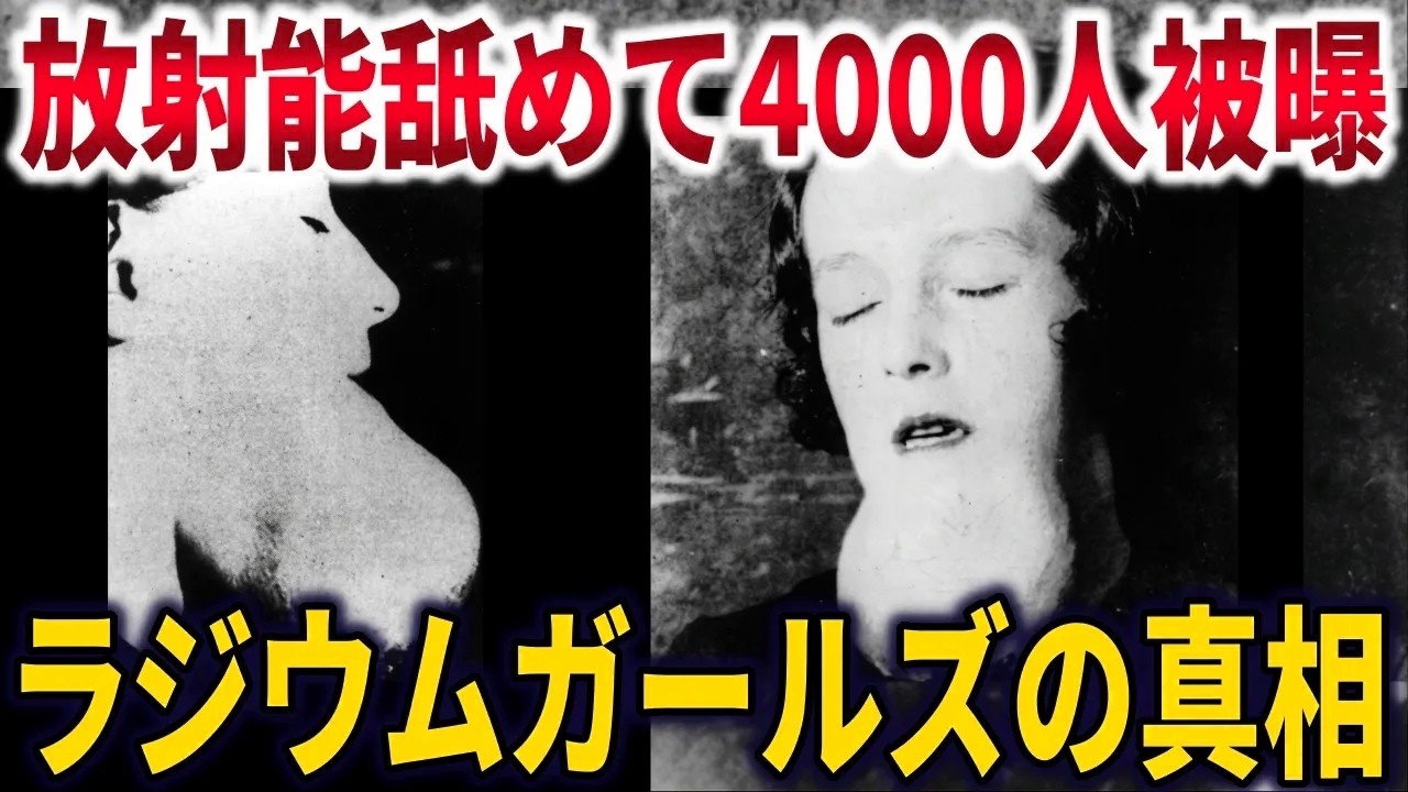 ラジウムガールズの真相。放射性物質で化粧していた女性労働者4000名の末路【ゆっくり解説】