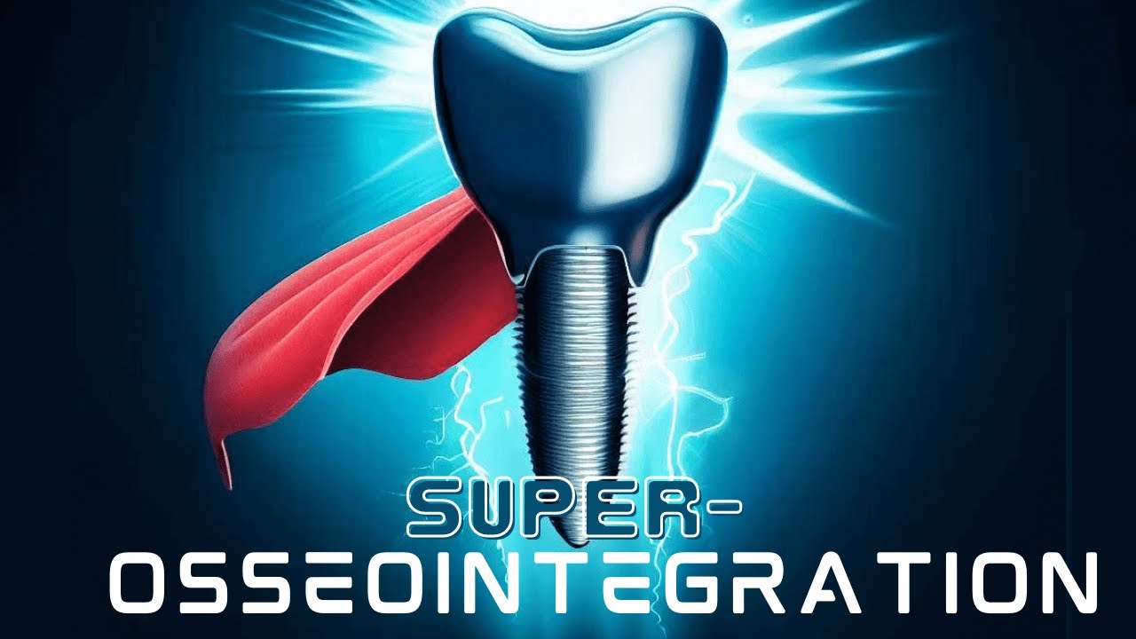 4 Ways to Boost Osseointegration of Your Implants! - PDP155