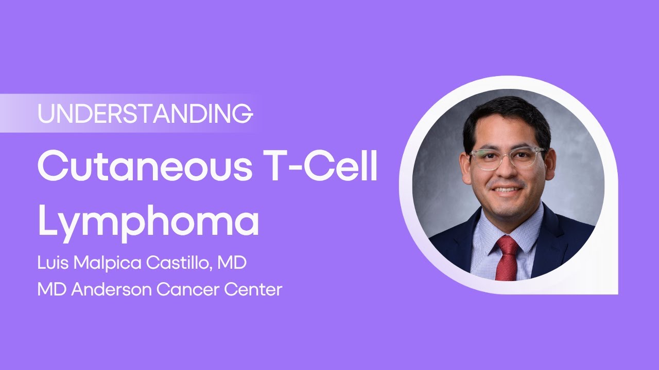 Understanding Cutaneous T-Cell Lymphoma