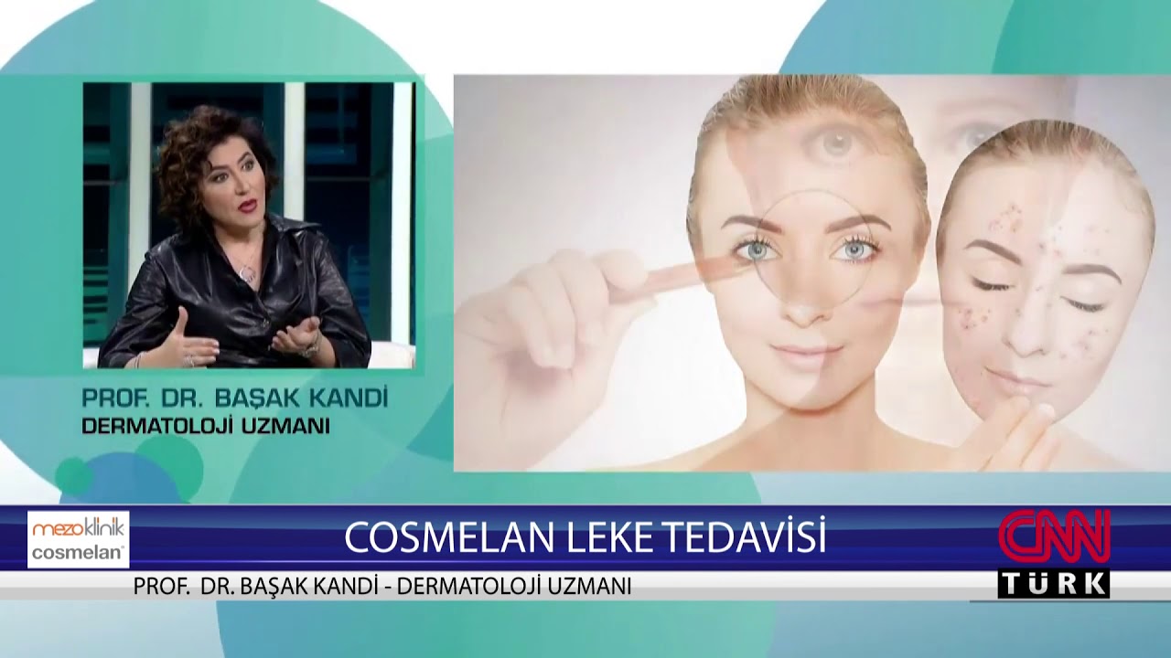 CNN Türk Sağlık Kontrolü Programı - Prof. Dr. Başak Kandi - Cosmelan Leke Uygulaması