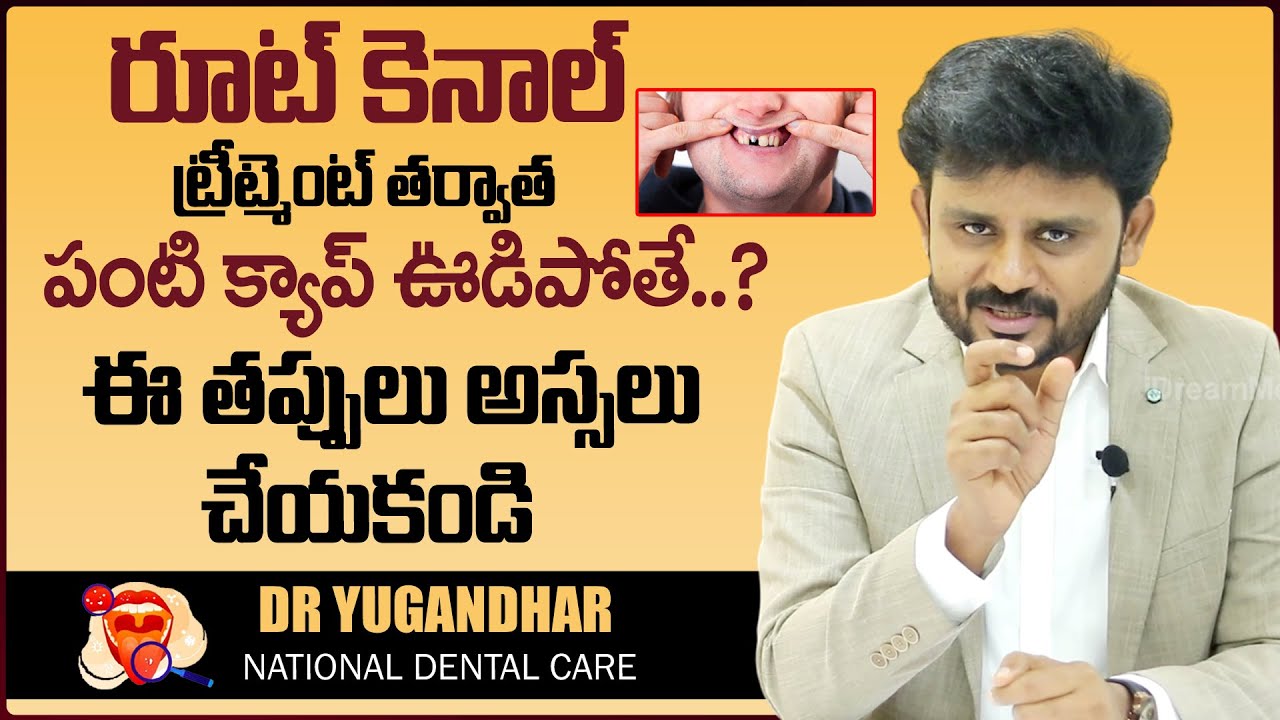 Top Reasons Why Dental Crowns Fall Off In Telugu | NDC | Dr Yugandhar | iDream Health