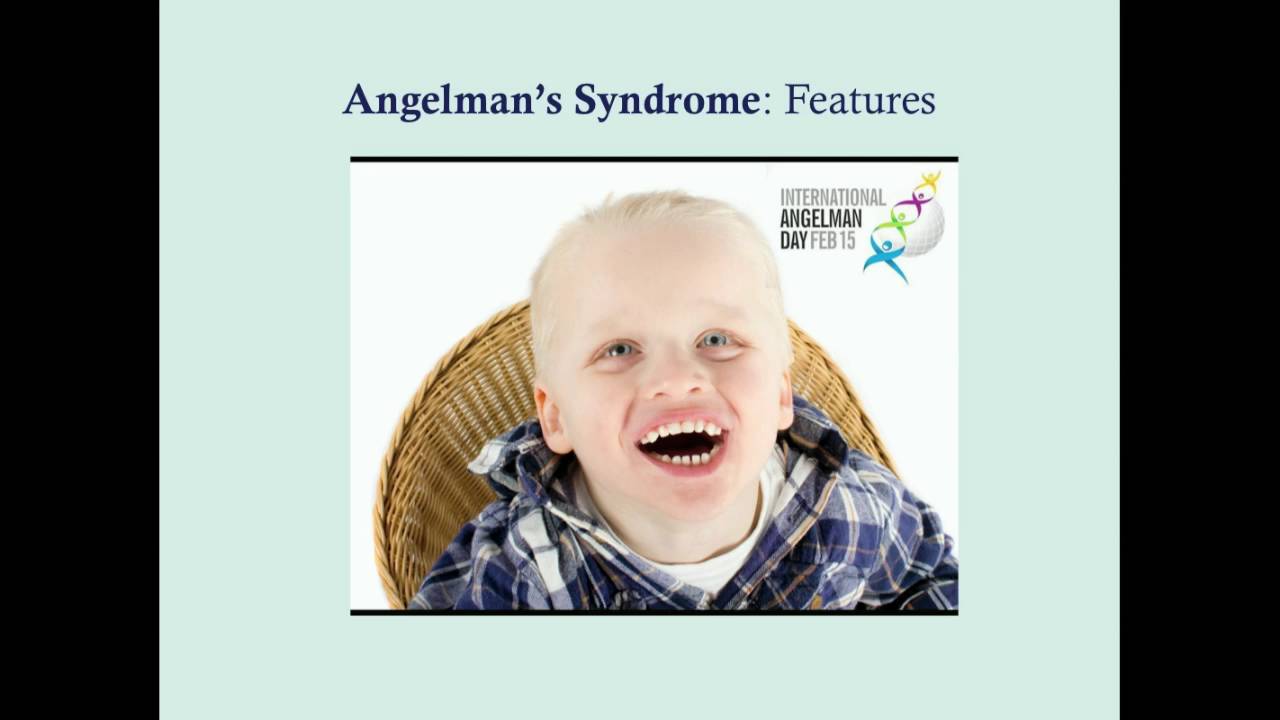 Angelman's Syndrome - CRASH! Medical Review Series