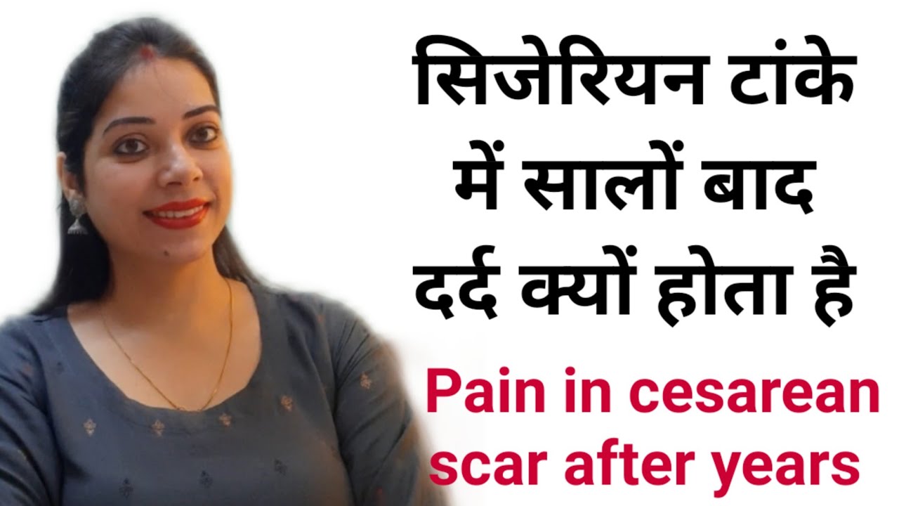 सिजेरियन टांके में सालों बाद दर्द क्यों होता है| Pain in cesarean scar after years | IndianMomsNest