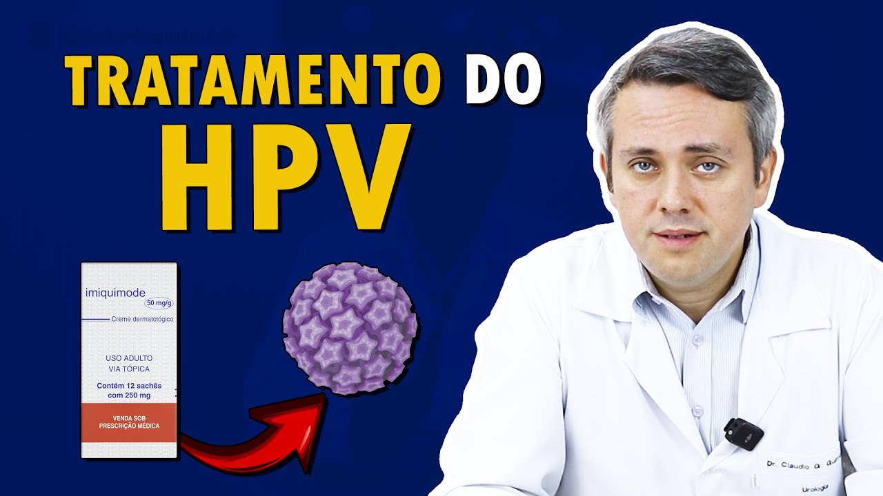 TRATAMENTO DE VERRUGAS GENITAIS (HPV) | Cortes Dr. Claudio Guimar&atilde;es