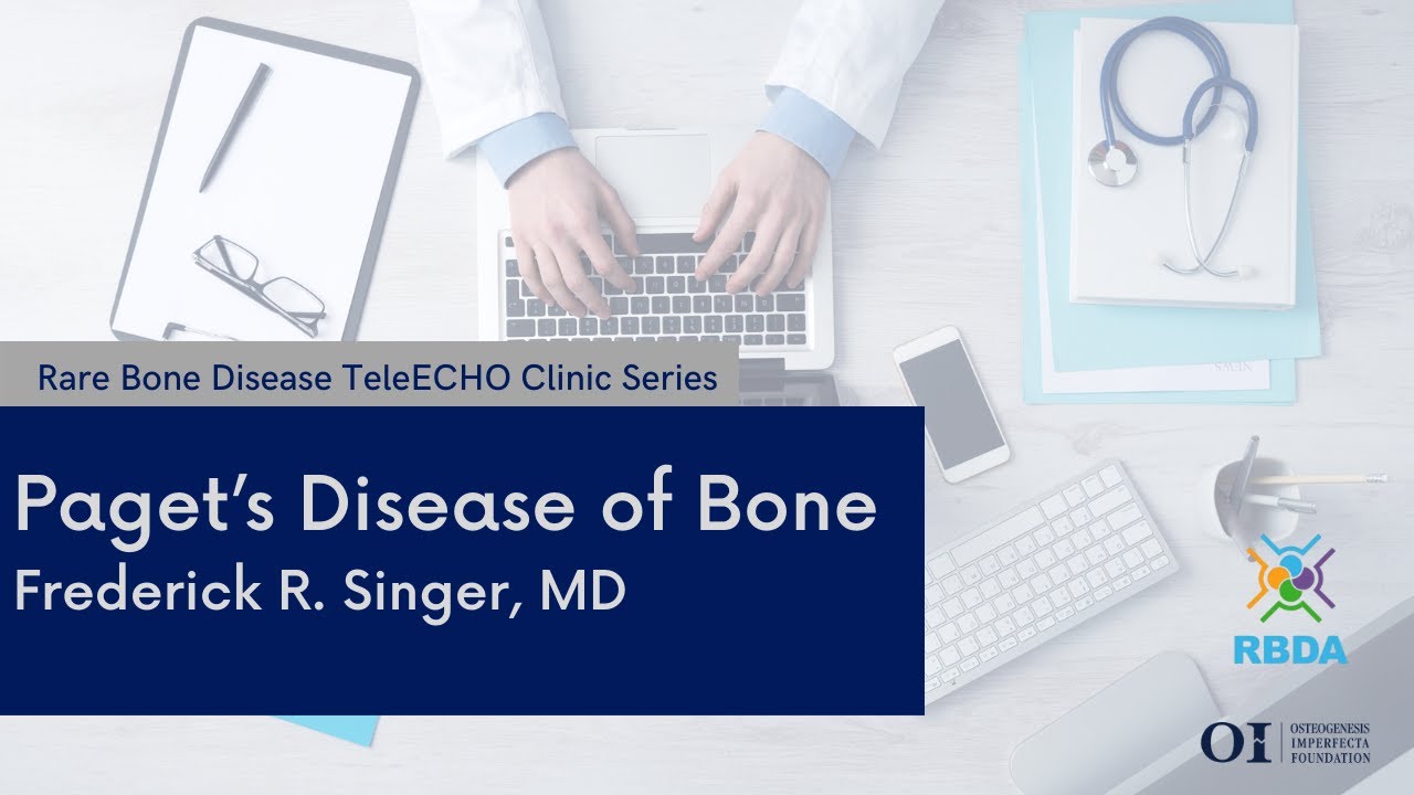 Paget’s Disease of Bone