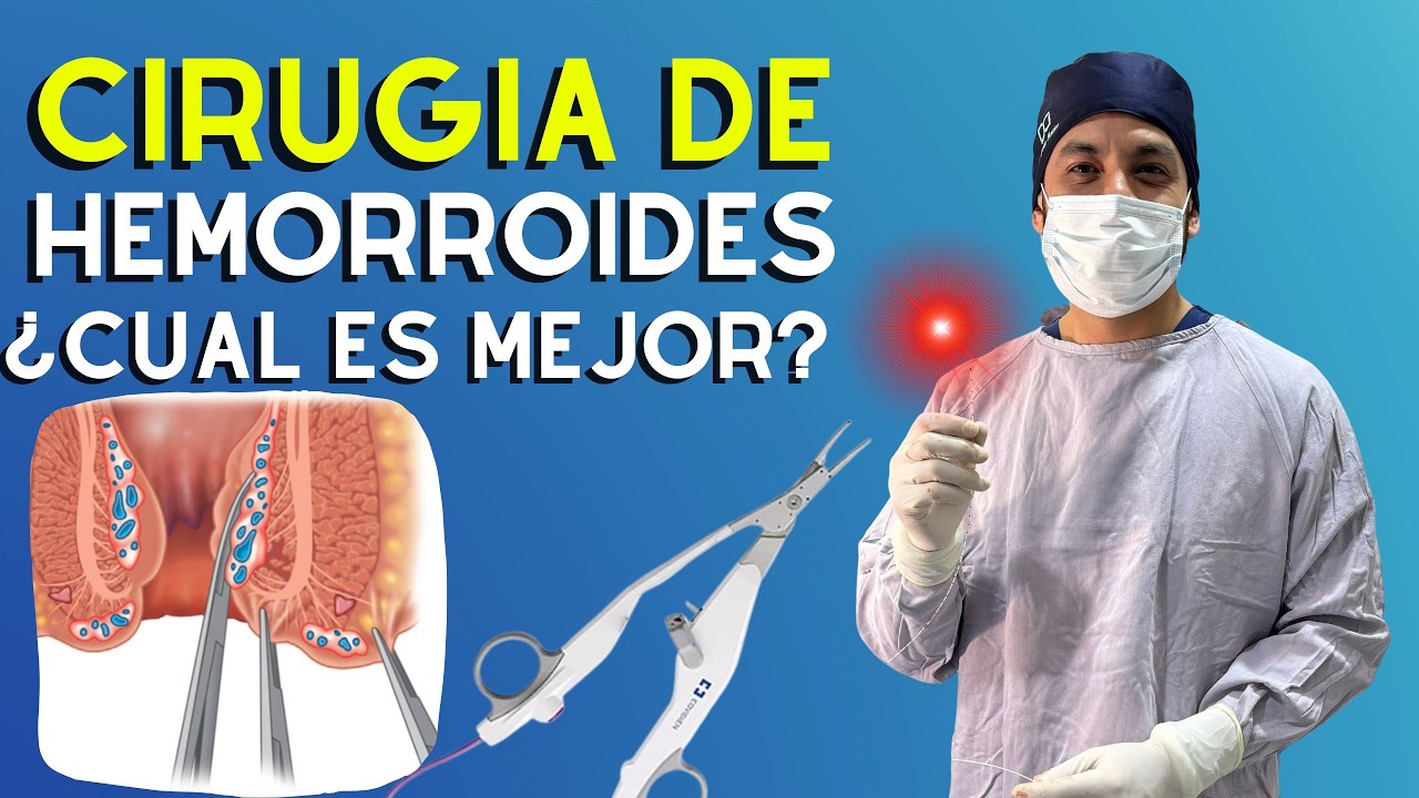 ✳️ Cirugía para Hemorroides: Tipos, Ventajas y Cuál es la MEJOR Opción