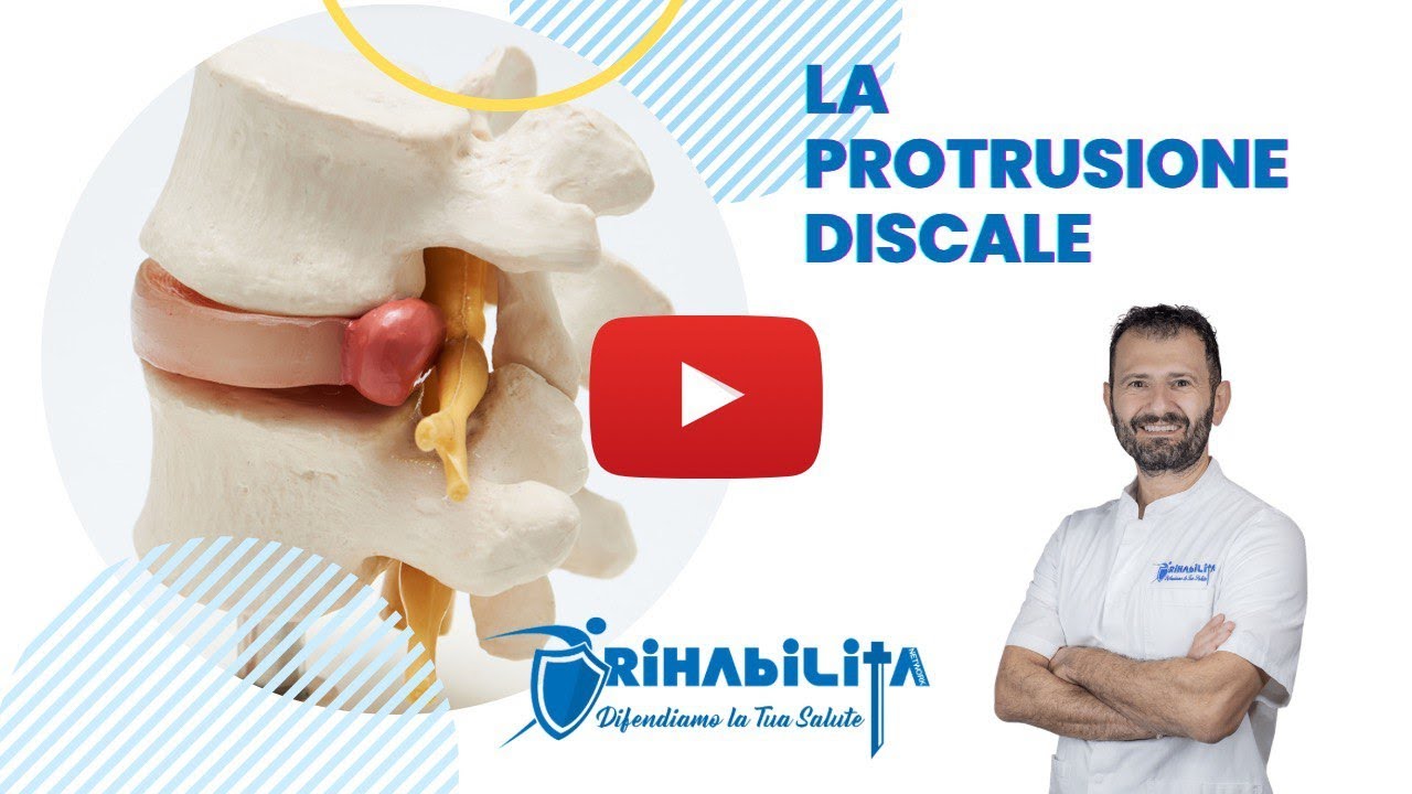 LA PROTRUSIONE DISCALE