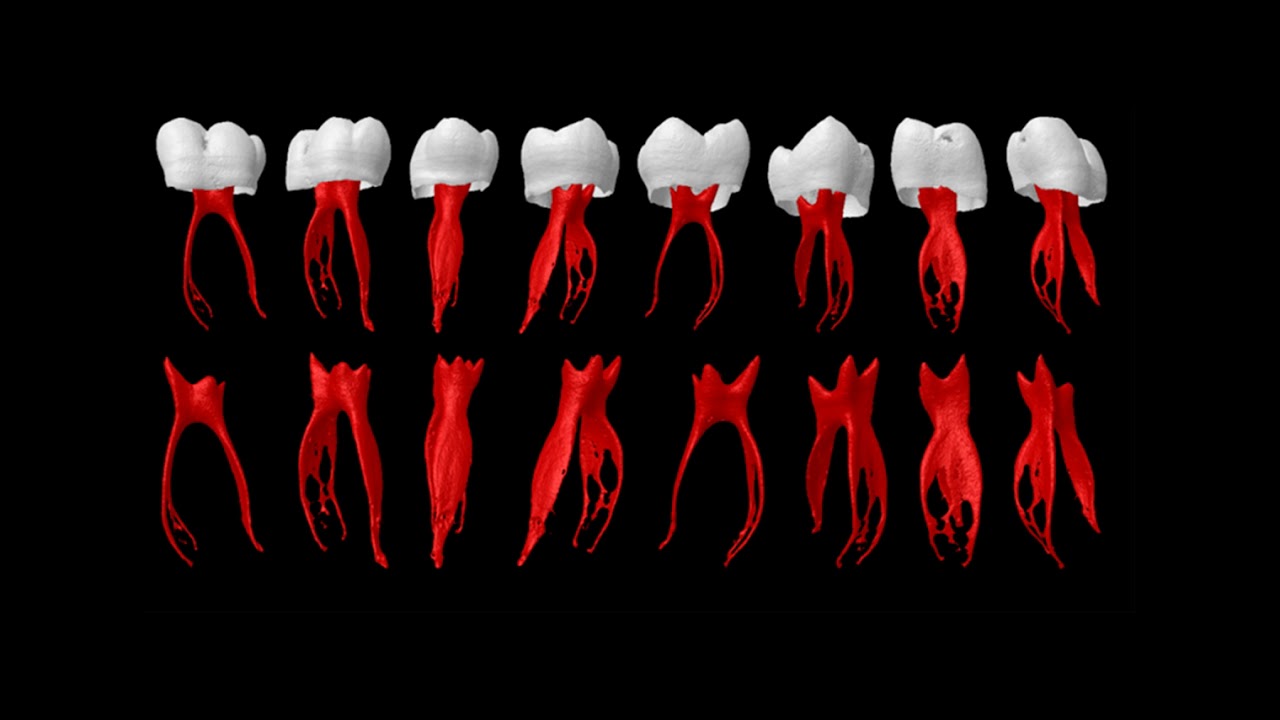 Endodontic applications of microcomputed tomography for studying root canals