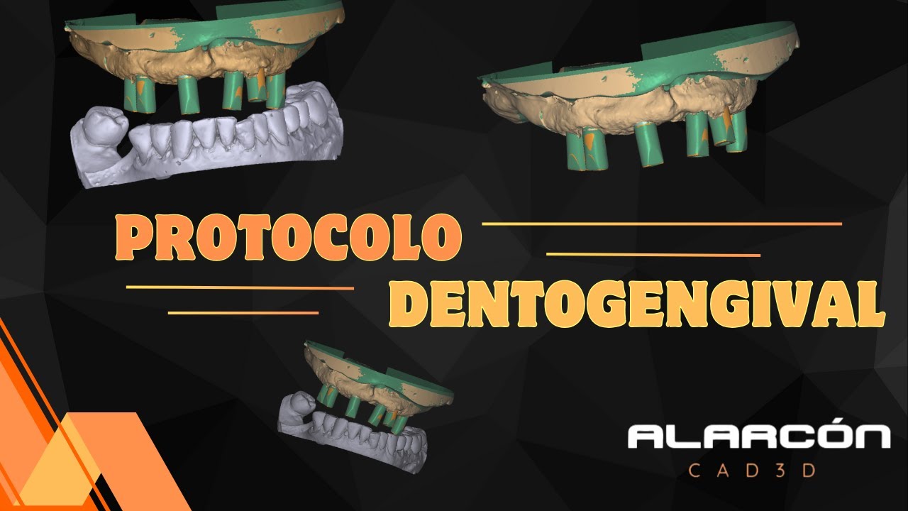 PROTOCOLO DENTO GENGIVAL #fluxodigital #exocad #cad