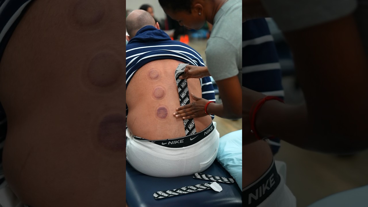 Does kinesiology tape work for lower back pain?