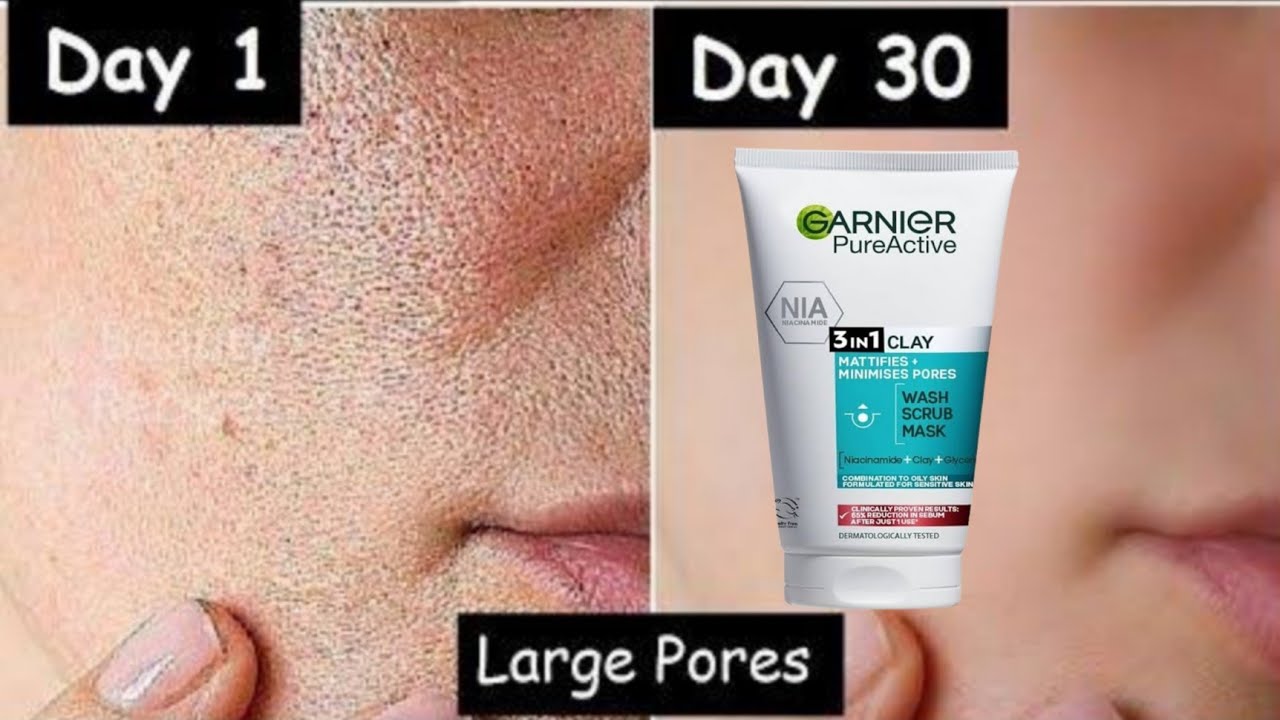 Review | Garnier Pure Active 3 in 1 স্কিনে জমে থাকা ময়লা দূর করে ফেলুন মাত্র ৫ মিনিটে  khadija begum