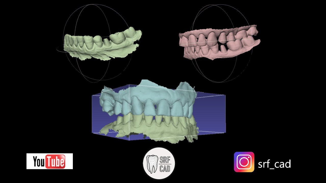 MESHLAB MESHMIXER DENTAL: Tutorial come allineare i modelli da impronta intraorale ALIGN INTRAORAL