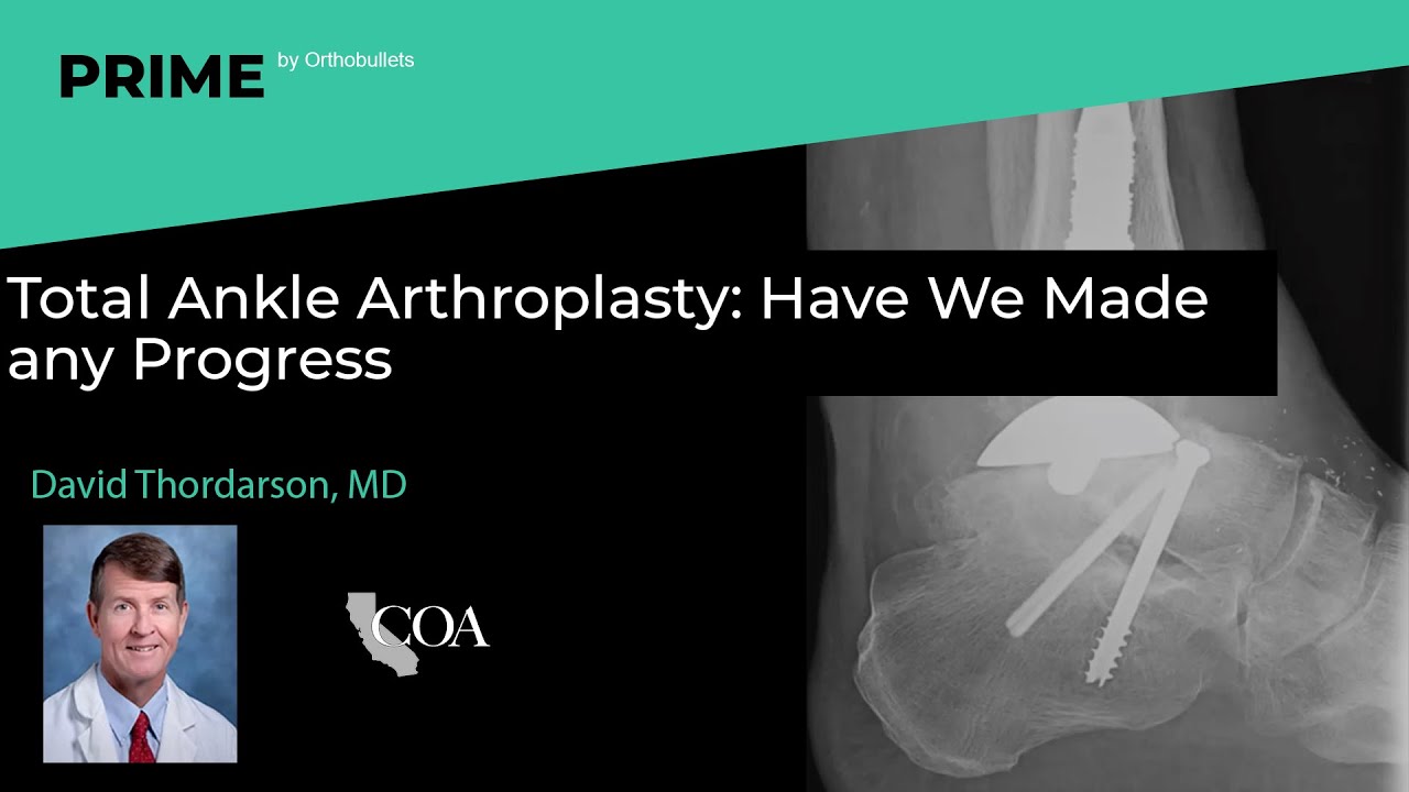 Total Ankle Arthroplasty  Have We Made any Progress - David Thordarson, MD