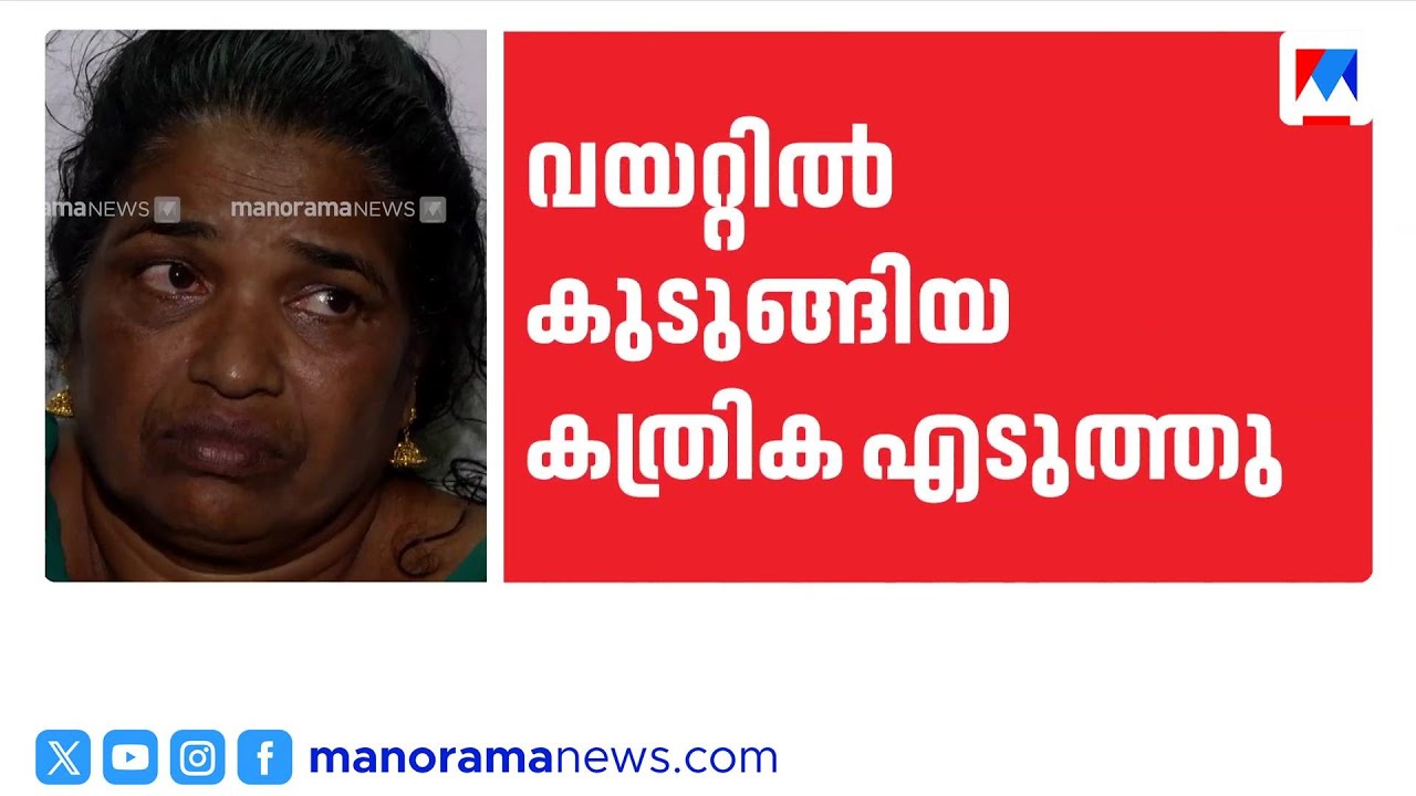 ഉഷയുടെ വയറ്റിൽ കുടുങ്ങിയ കത്രിക പുറത്തെടുത്തു; ശസ്ത്രക്രിയ വിജയകരം | Usha artery forceps removed