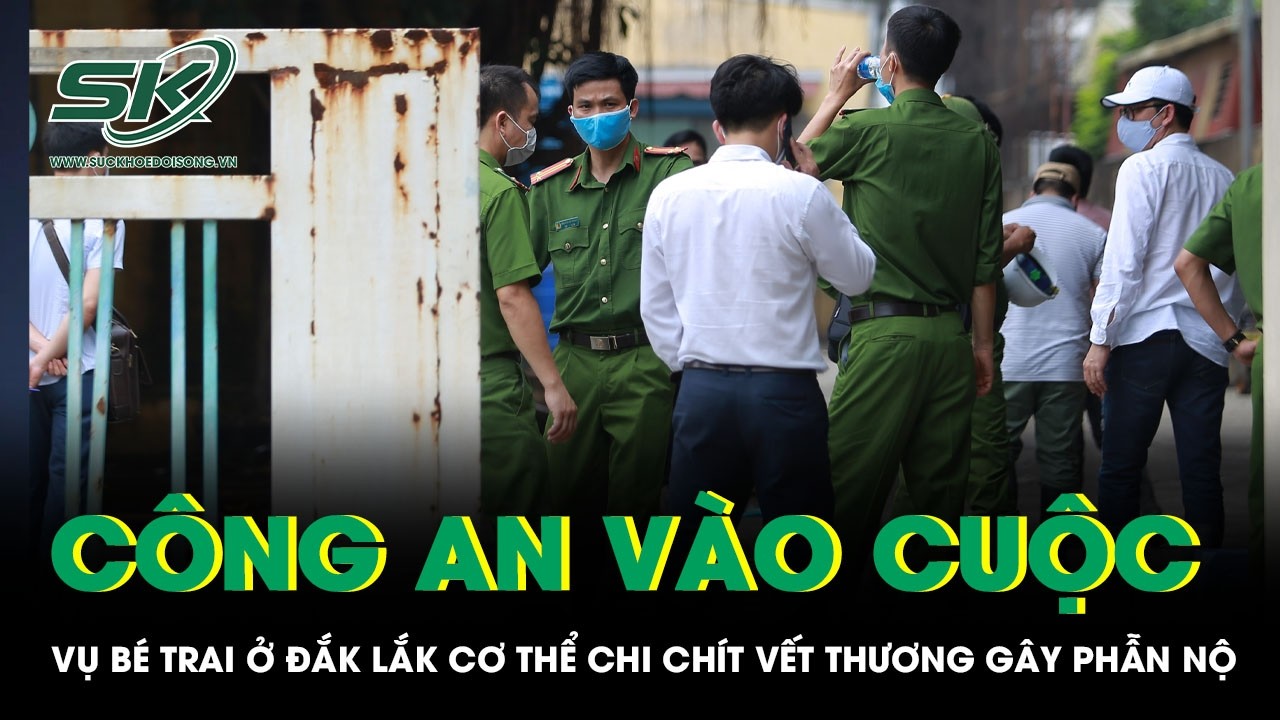 Vụ bé trai ở Đắk Lắk cơ thể chi chít vết thương gây phẫn nộ: Công an vào cuộc