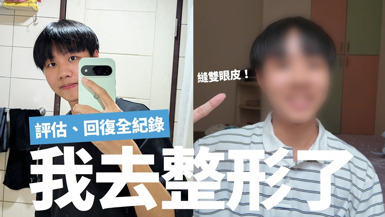 為什麼要整型？縫雙眼皮會痛嗎😱？兩周回復狀況全紀錄！