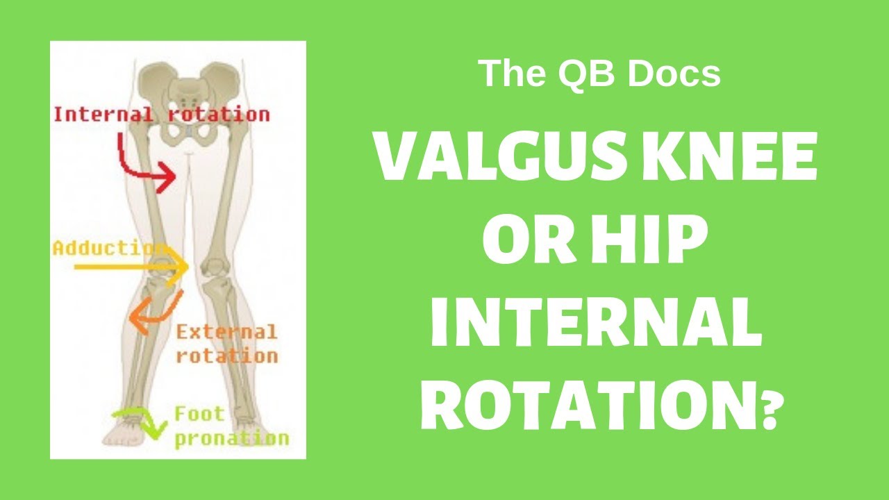 The QB Docs: Hip Internal Rotation vs Knee Valgus