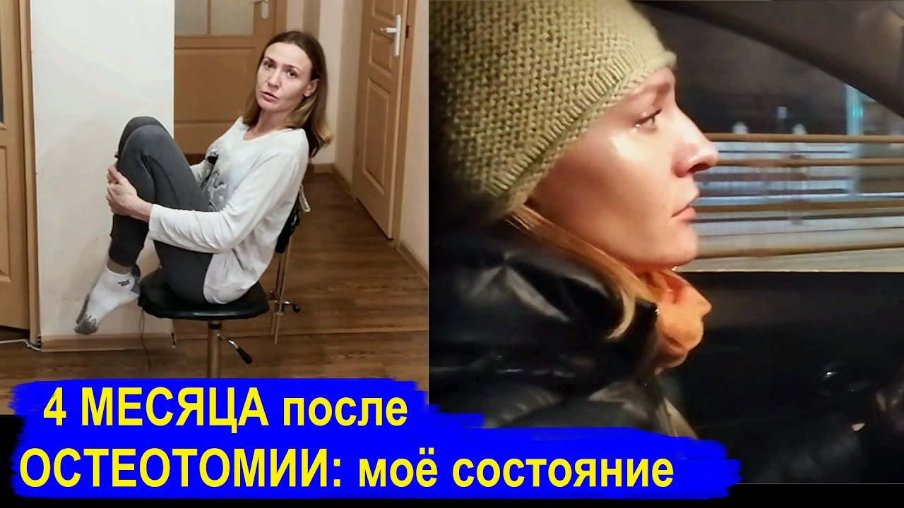 4 месяца после тройной остеотомии таза: ПОХОДКА, СОСТОЯНИЕ, НАСТРОЕНИЕ. Баня против Коронавируса)