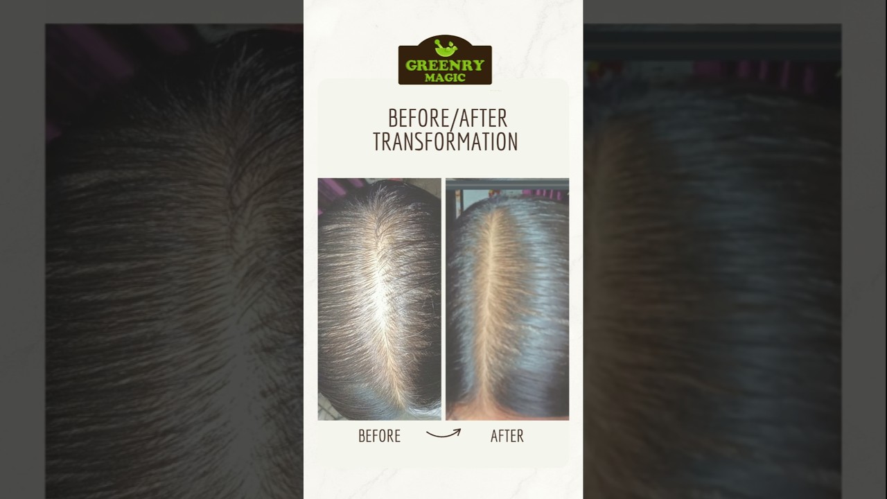 Review Time | Cleint Result After Using Kapurkachri Hair Booster Oil 
