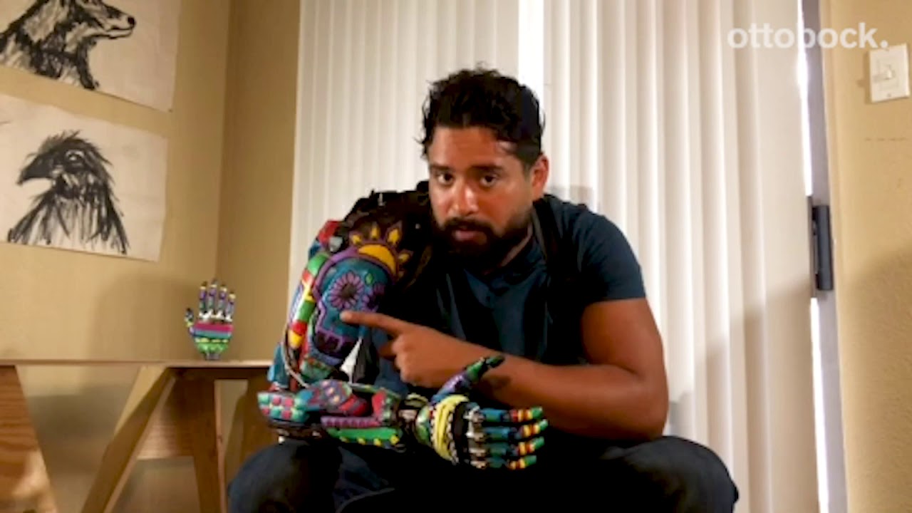 Sebastian's bebionic story