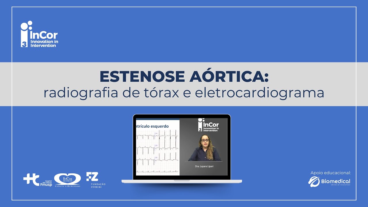 Estenose aórtica: radiografia de tórax e eletrocardiograma