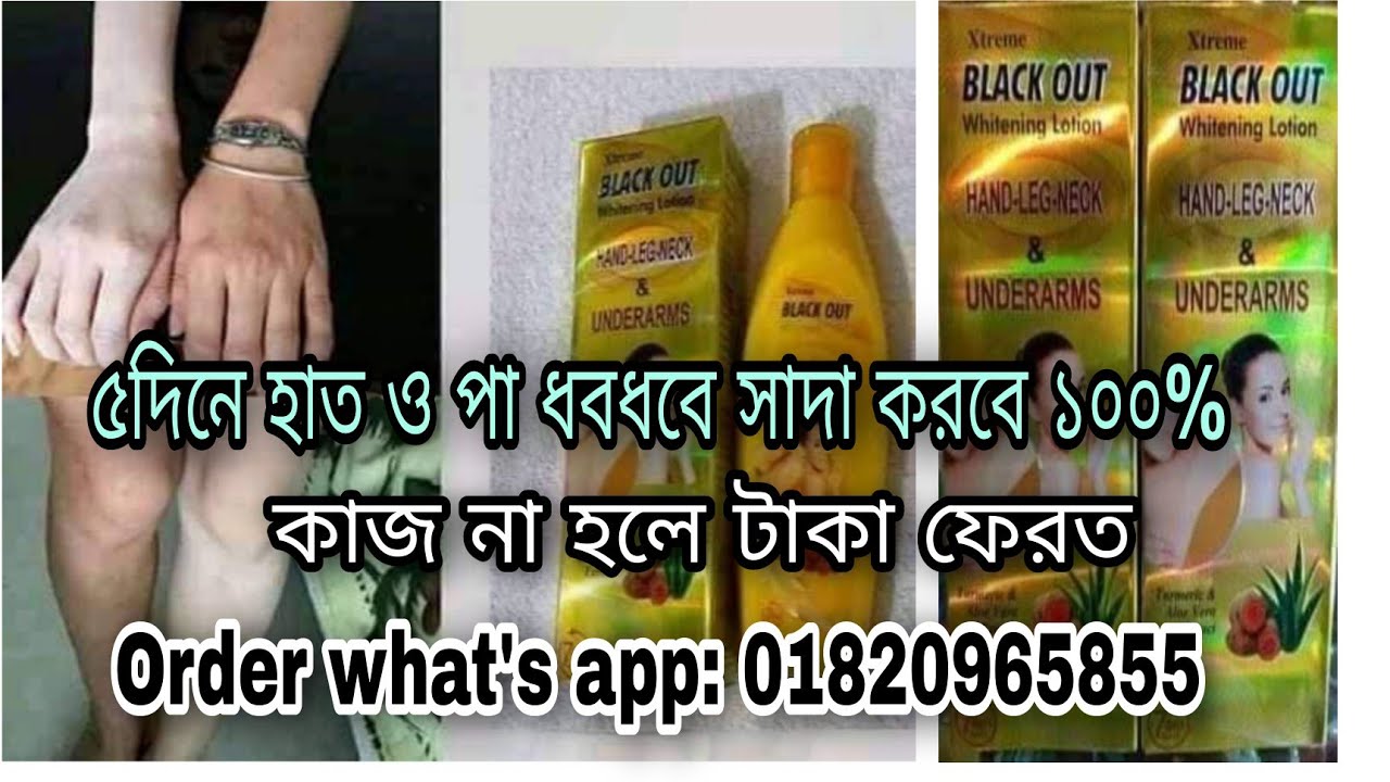 হাত ও পা ফর্সা করার উপায়।। black out whitening body lotion।৫ দিনে হাত ও পা ধবধবে সাদা করবে ১০০%।।