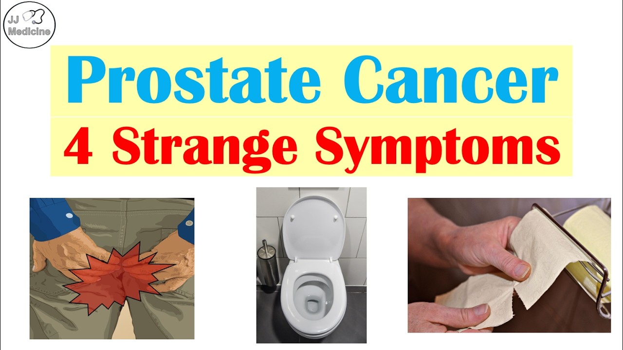 Think It’s a Gut Issue? 4 Surprising Symptoms Linked to Prostate Cancer