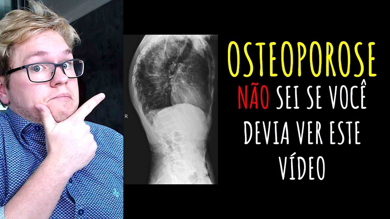 OSTEOPOROSE - NÃO SEI SE VOCÊ DEVERIA VER ESTE VÍDEO!