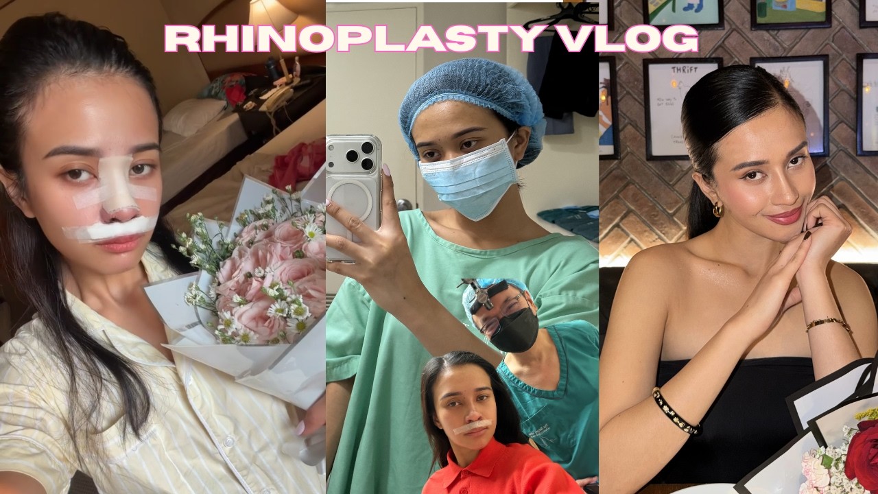 I Finally Did It… My Rhinoplasty Journey ✨