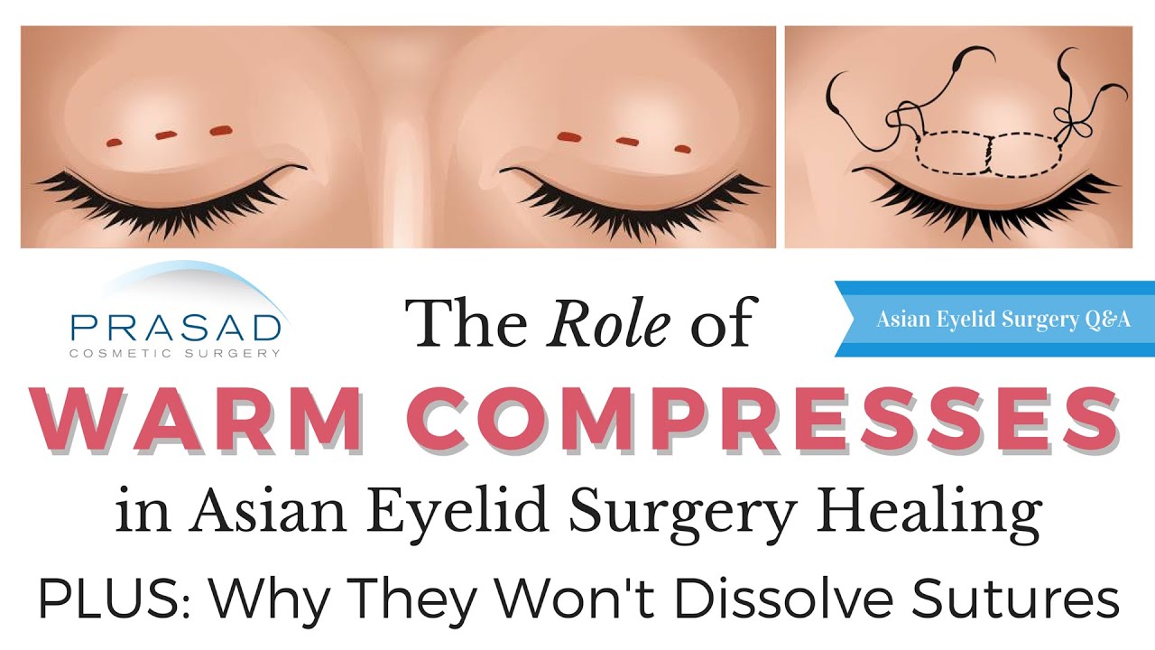 Why Warm Compresses in 2nd Phase of Eyelid Surgery Healing Won't Dissolve Sutures