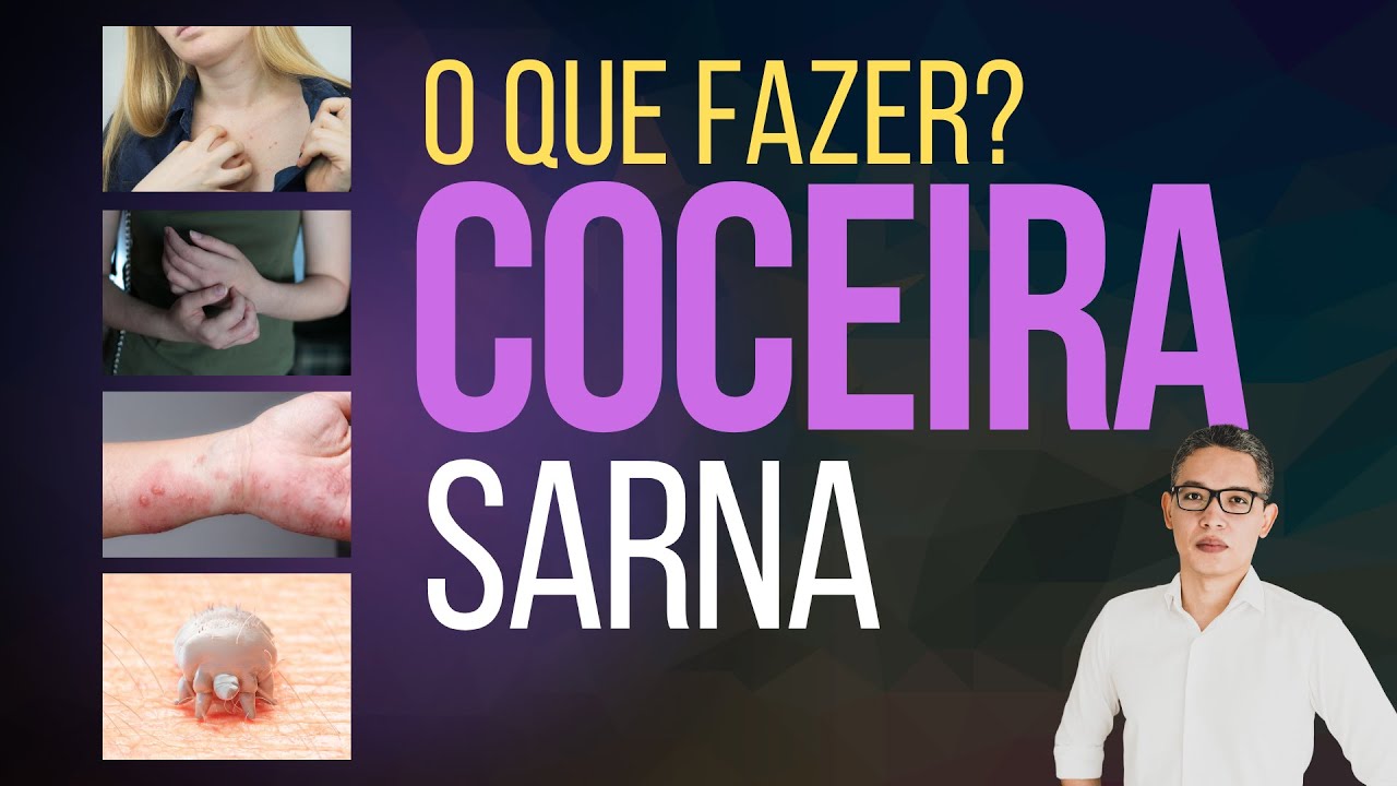 COCEIRA NO CORPO PINICANDO | ALÍVIO IMEDIATO? SARNA? | Bicho e Remédio para Coceira no corpo