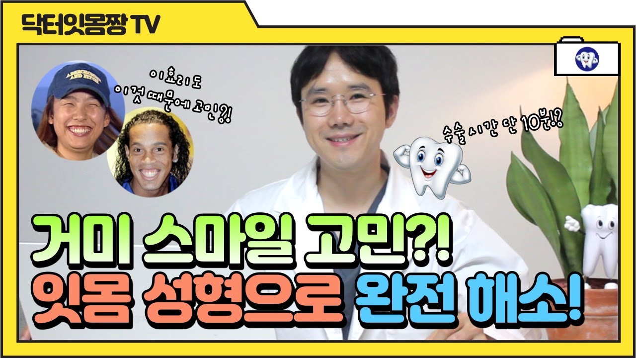👍거미스마일 👍 웃을 때 잇몸이 많이 보이는 분들 !! 잇몸성형으로 해결 !!
