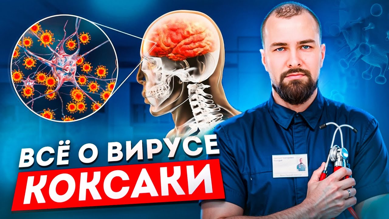 Энтеровирусная инфекция (Коксаки)