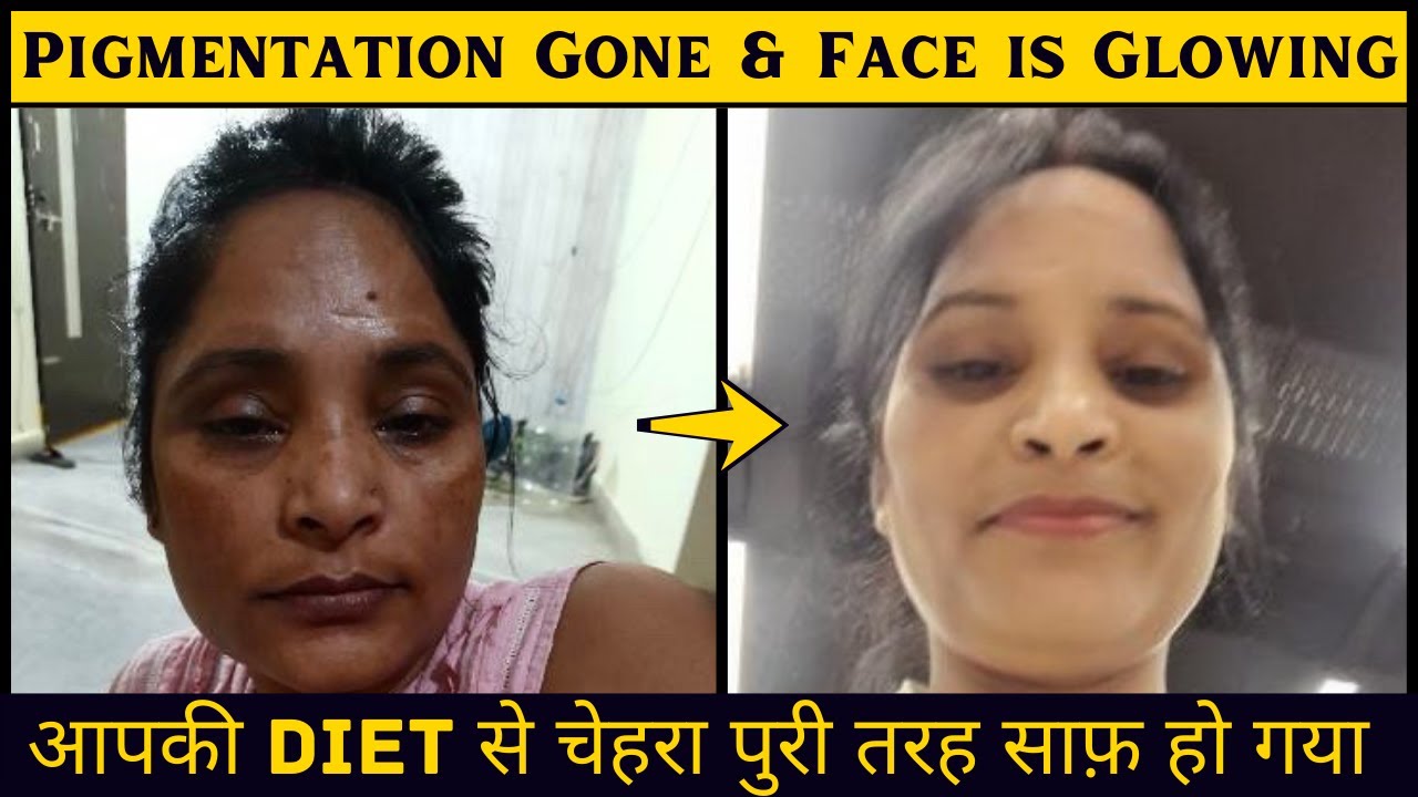Sangeeta's Incredible story, 