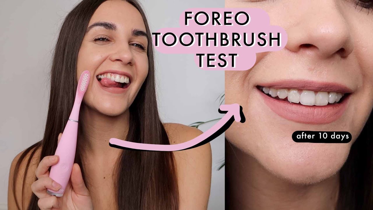 I'VE TRIED FOREO ISSA 3 SONIC TOOTHBRUSH FOR 10 DAYS | BEFORE AND AFTER  *i'm in love*