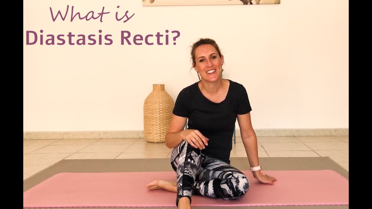 What is Diastasis Recti (Diastasis test and rehab)
