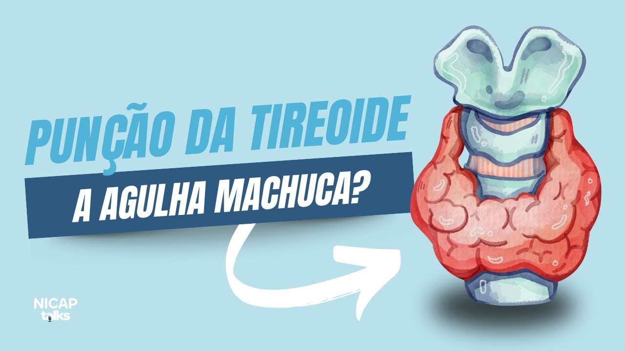 Como funciona a Punção Aspirativa da Tireoide? | 10 Minutos com o cirurgião #EP6