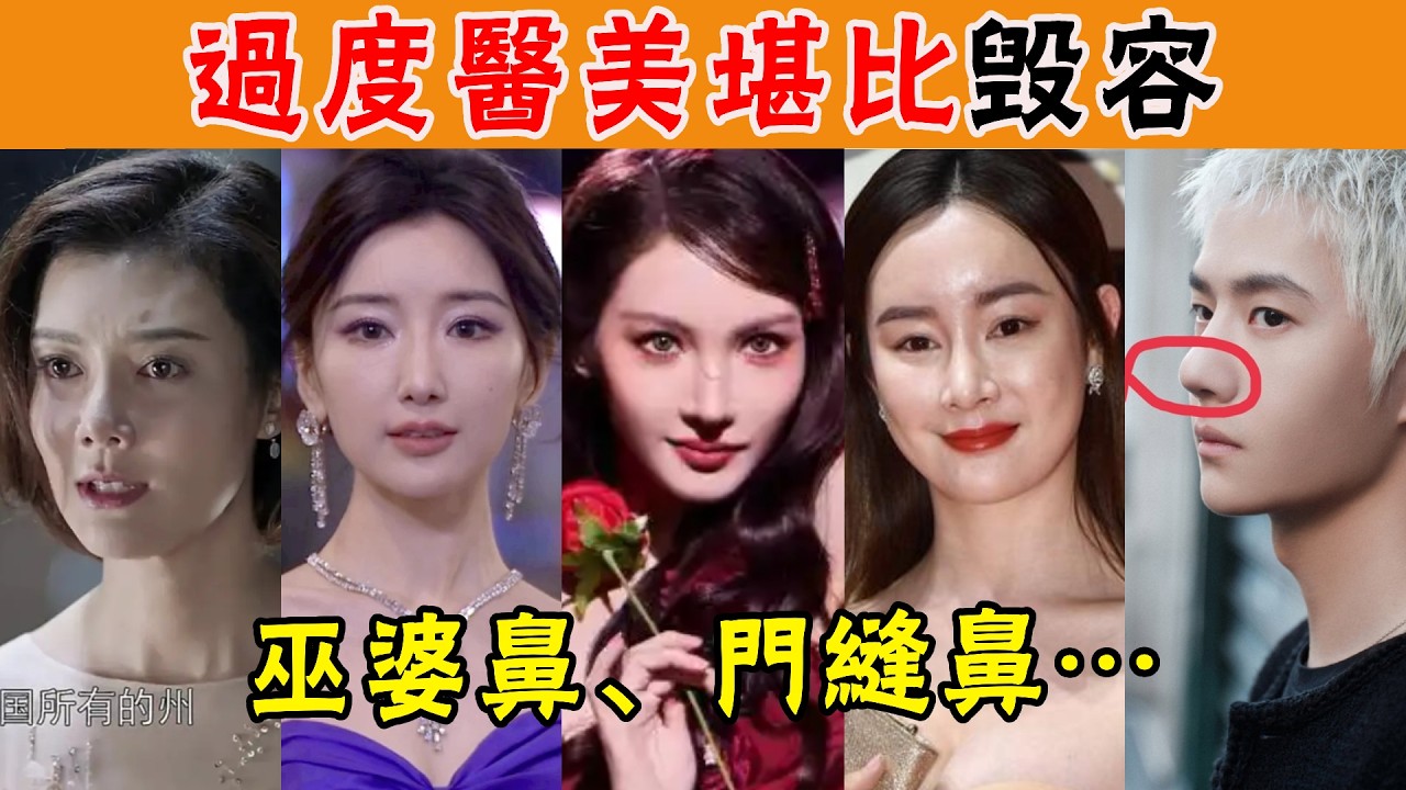 明星的鼻子能有多奇怪？巫婆鼻，豬鼻子，門縫鼻，縫縫補補又是一個新鼻子，過度醫美堪比毀容#金晨#車曉#張雨綺#牛莉#張檬#謝依霖#蕭亞軒#王一博#王佑碩#楊冪#白敬亭#沈夢辰#歐陽娜娜#鞠婧禕